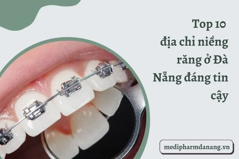 Top 10 địa chỉ niềng răng ở Đà Nẵng đáng tin cậy